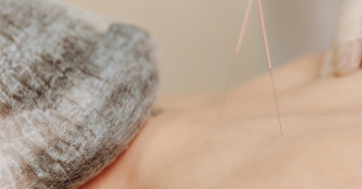 Comparing Japanese Acupuncture to Traditional Chinese Methods