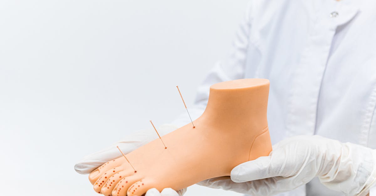 Exploring the Educational Pathways for Acupuncturists in Brisbane