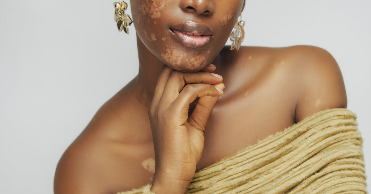 How Acupuncture Enhances Mental Wellbeing and Reduces Stress