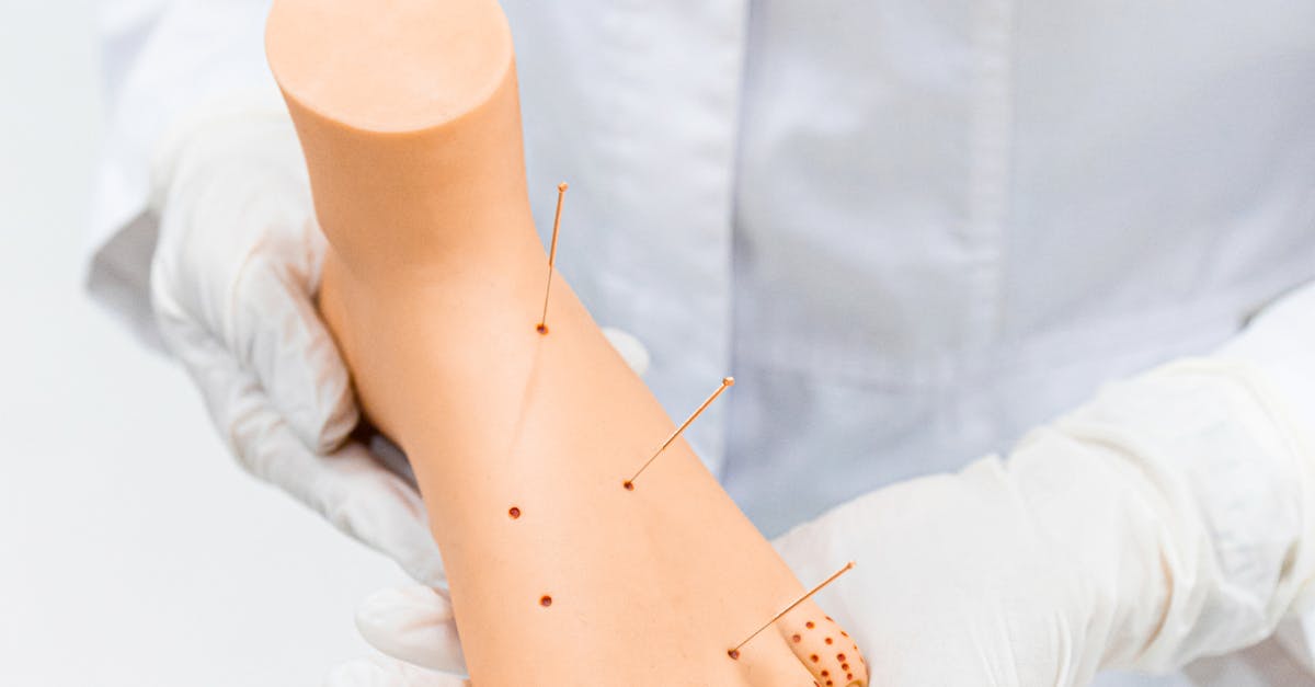 Questions to Address Acupuncture Safety and Hygiene Practices in Brisbane