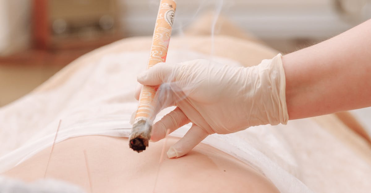 The Impact of Regular Acupuncture Sessions on Stress Levels