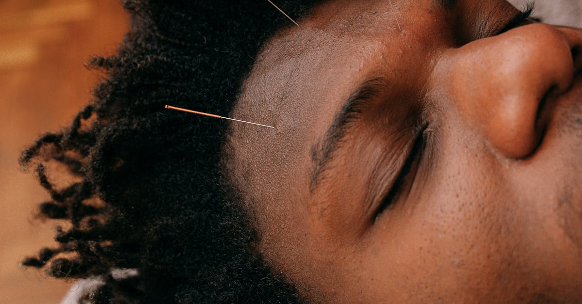 The Role of Auricular Acupuncture in Modern Therapies