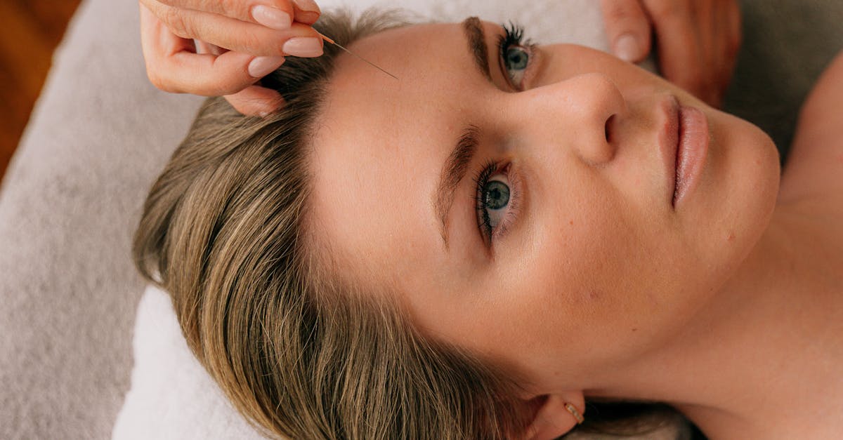 Understanding the Principles of Japanese Acupuncture Techniques